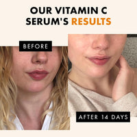 Vitamin C Face Serum Dark Spot Remover Facial Serum